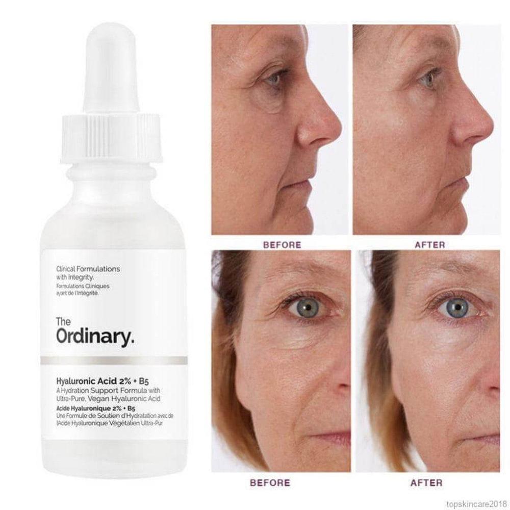 Ordinary Korean serum